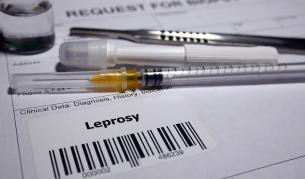 Случаи на проказа са регистрирани в Хърватия и Румъния