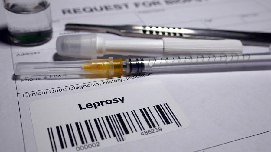 Случаи на проказа са регистрирани в Хърватия и Румъния