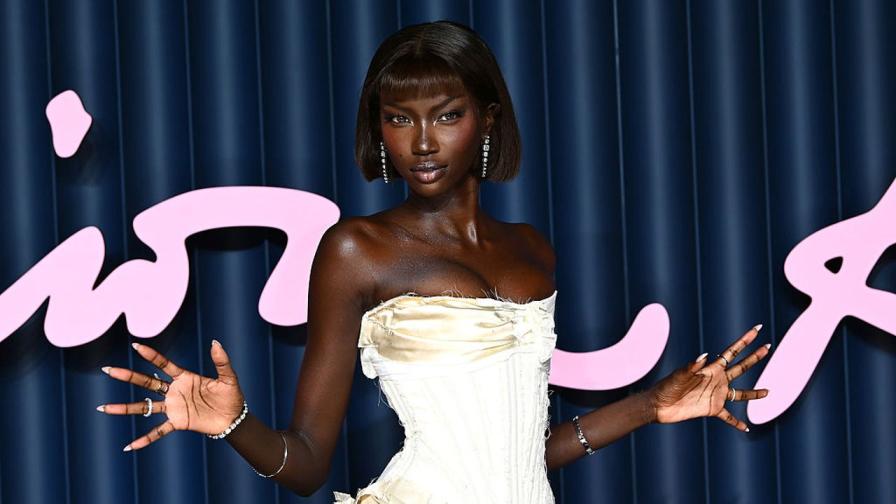 Супермоделът Анок Яй претърпя животоспасяваща процедура заради сепсис