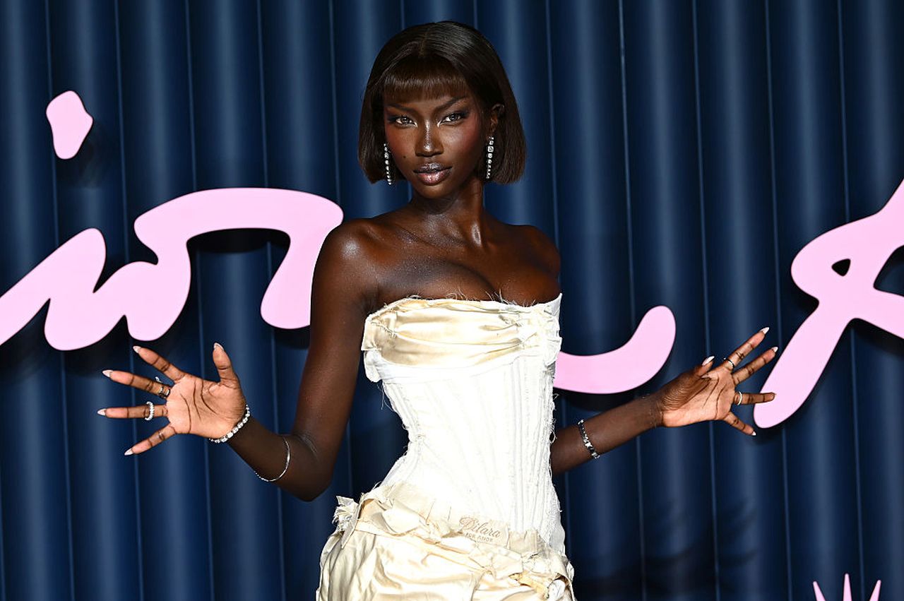 Супермоделът Анок Яй претърпя животоспасяваща процедура заради сепсис