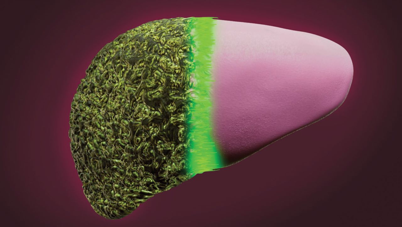 Биофилтър спасява черния дроб