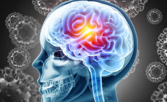 Заплахата бактериален менингит: Какво трябва да знаем и къде е България