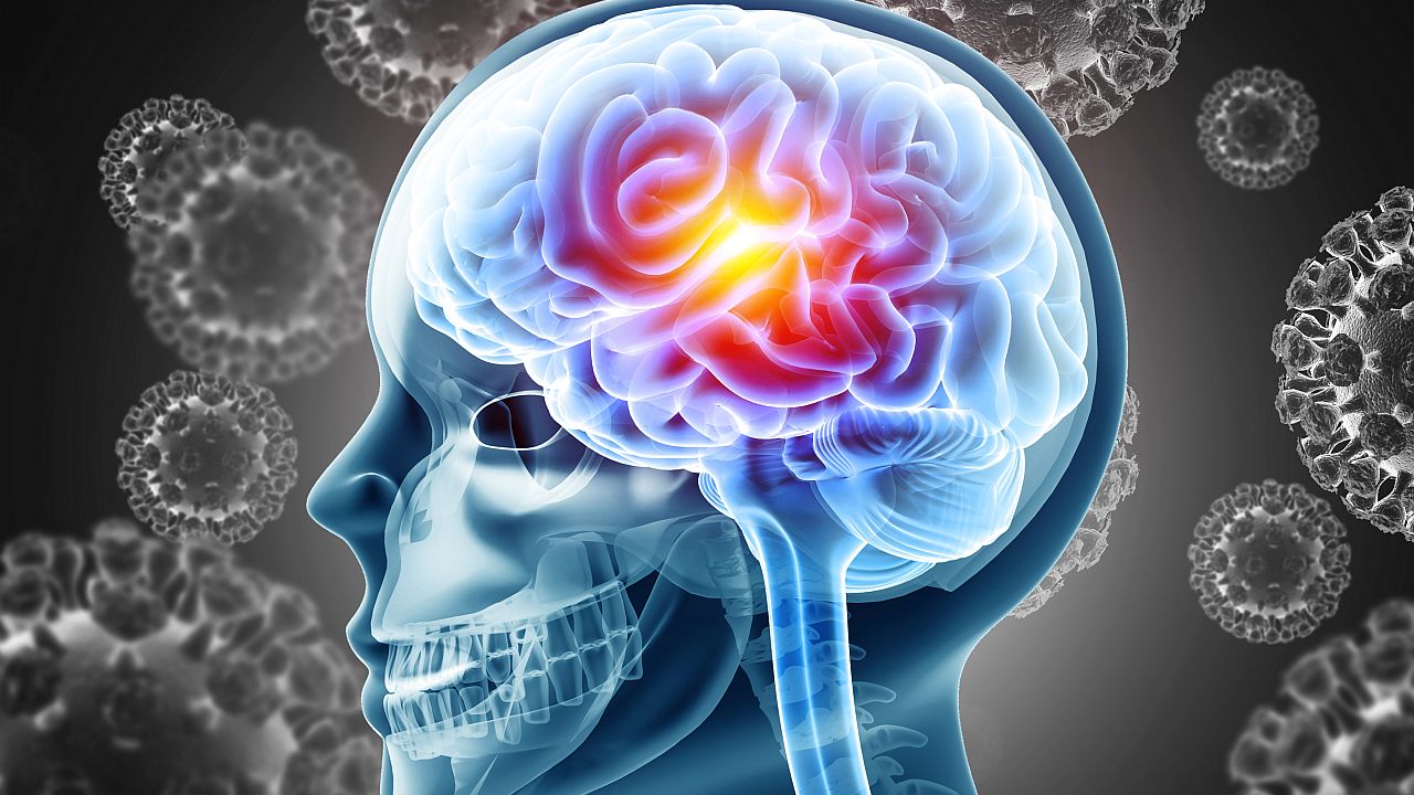 Заплахата бактериален менингит: Какво трябва да знаем и къде е България