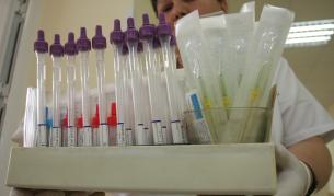 Хиляди ще трябва да влязат в болници за изследвания и смяна на терапията, а болниците нямат такъв капацитет.