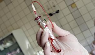 Ученици се тестват за СПИН в Плевен