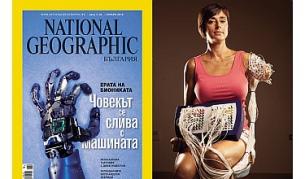 Сензорите проследяват мускулните движения в запазената част от ръката на Аманда Китс