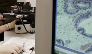 Салмонелата - новият лек срещу рака?