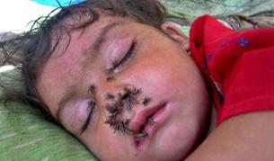 ООН предупреждава, че 3,5 млн. деца в Пакистан са застрашени от болести, предавани по воден път