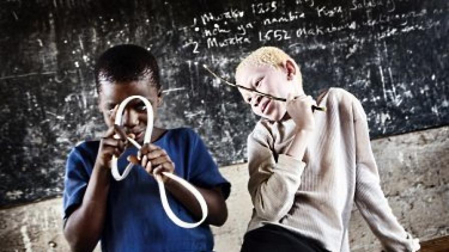 Снимката на годината на УНИЦЕФ за 2009 г., изобразяваща танзанийско дете с приятелчето му албинос