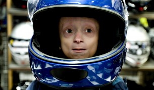 11-годишно момче с прогерия