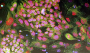 Стволови клетки