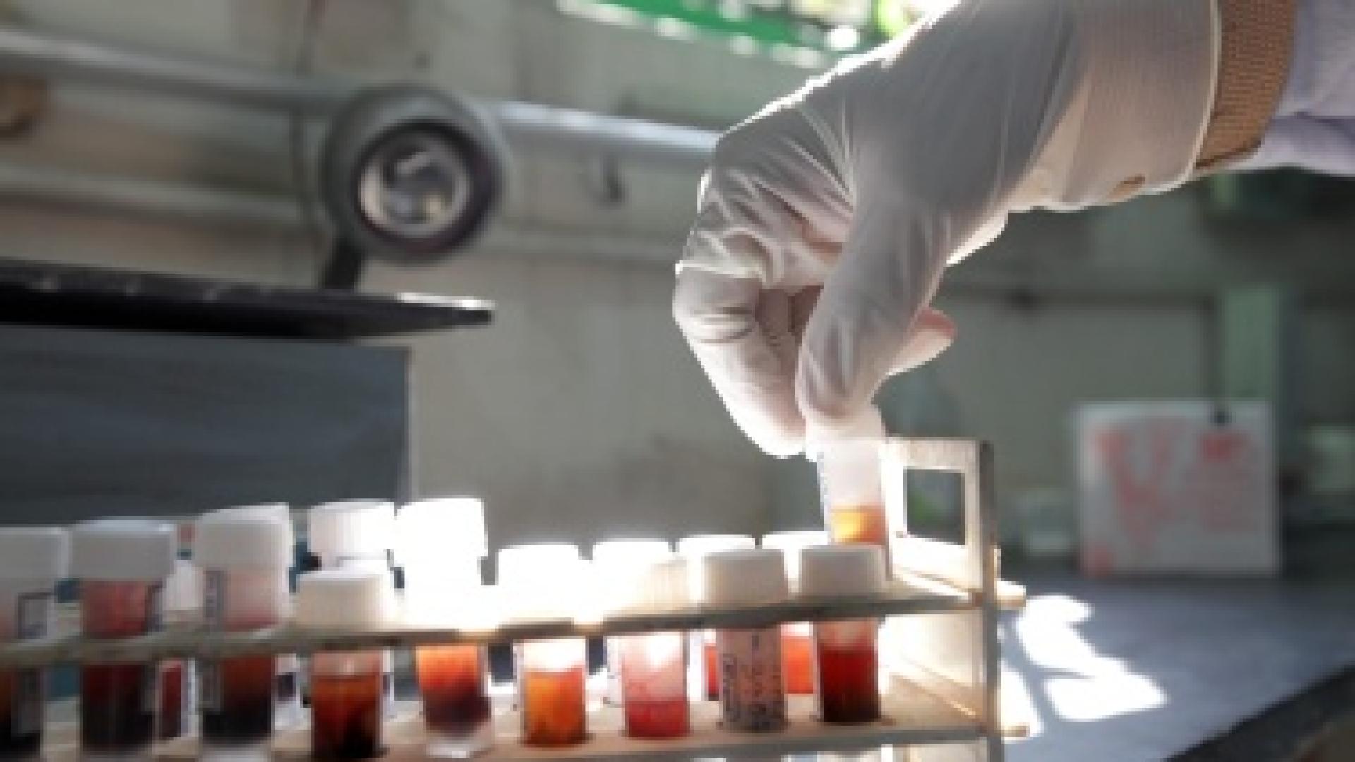 Една обикновена кръвна проба може да промени облика на скрининга