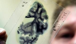 Мозъчна стимулация ще ни помага да решаваме задачи