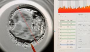 Проплака първото бебе, създадено с по-безопасен метод инвитро